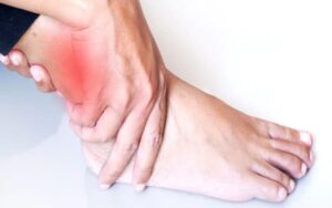 Cara Pijat Keseleo Yang Benar